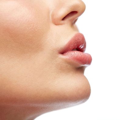 Cirugía Facial Lifting de Labios Tijuana